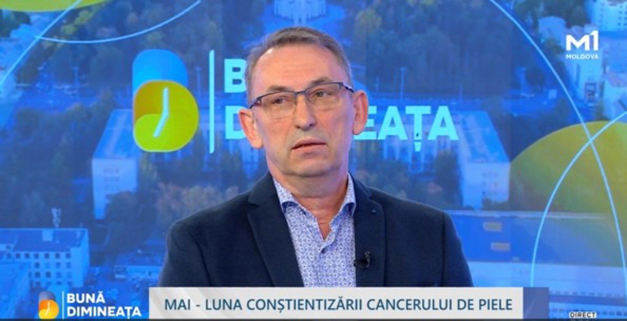 Cancerul de piele, în creștere în Moldova: expunerea la soare, principală cauză