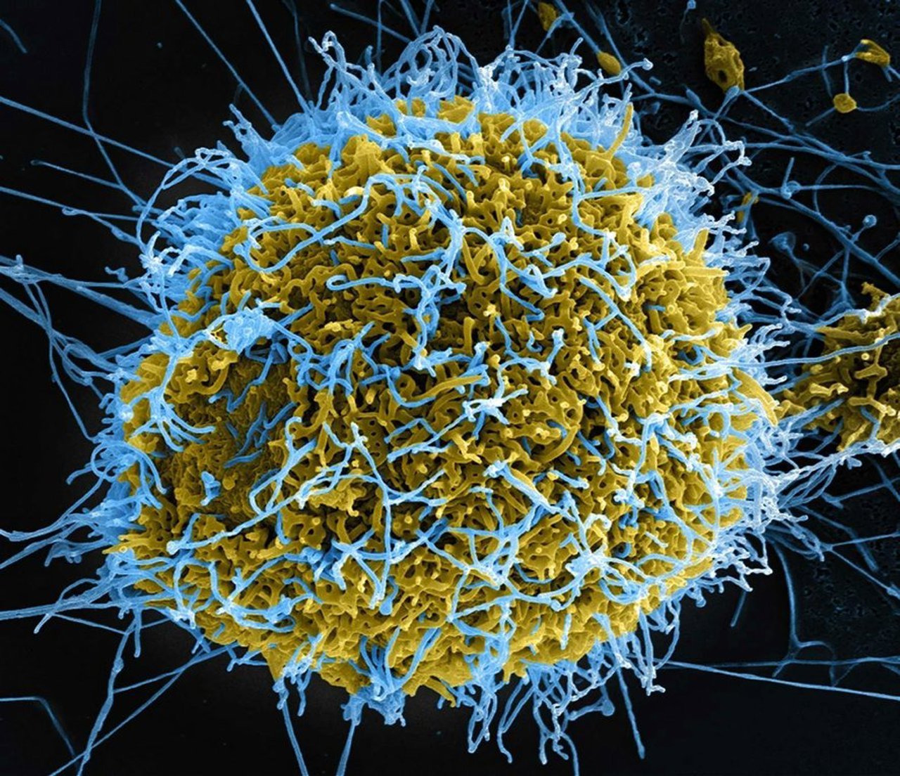 Epidemia de Ebola provoacă 204 decese în RDC, risc de extindere în alte țări africane